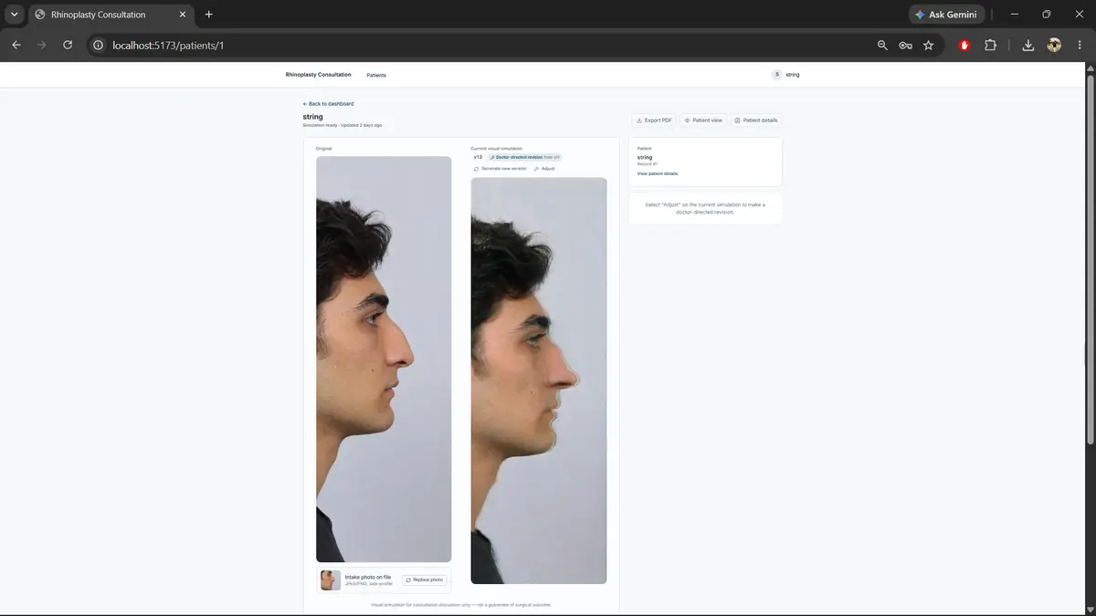 Patient consultation view showing an original photo alongside the AI-generated rhinoplasty simulation, side by side